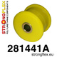 ARM DE RADIUS AU SPORT DE DIFF